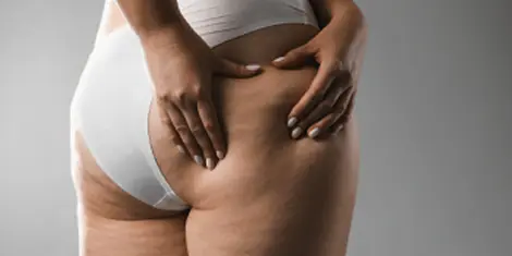 gluteos relacionado 2
