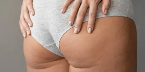 gluteos relacionado